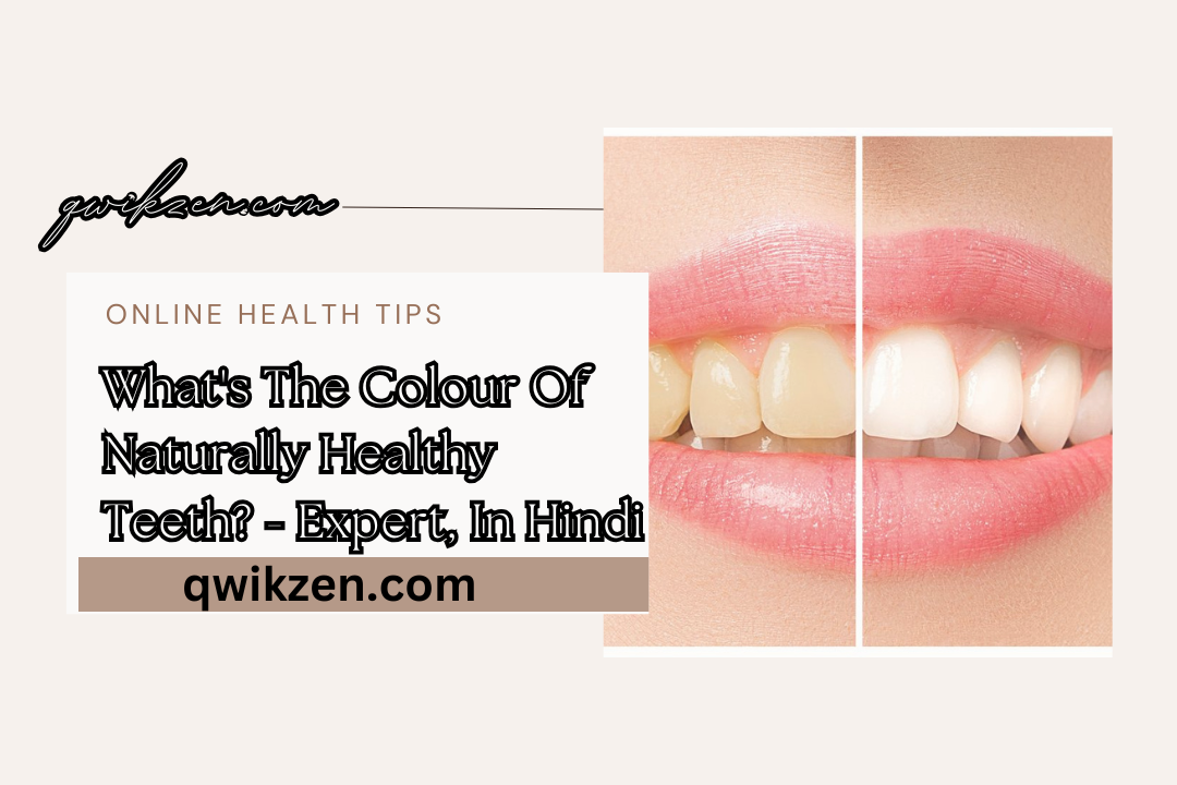 What's The Colour Of Naturally Healthy Teeth? - Expert, In Hindi